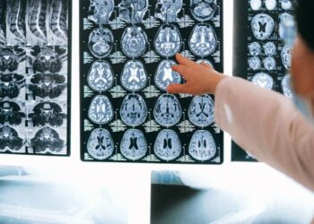 What Caused Sean's Brain Injury? The Real Story Behind It