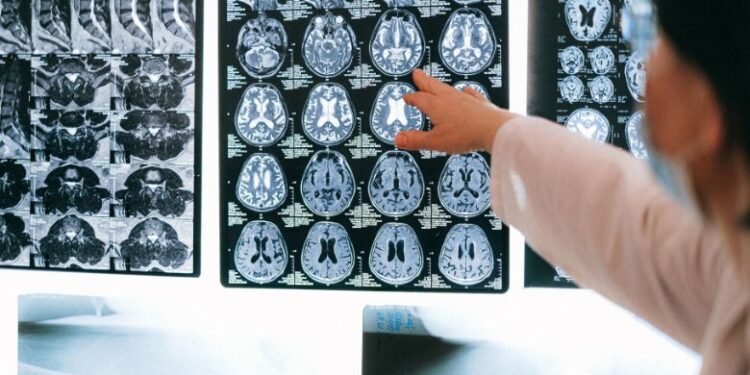 What Caused Sean's Brain Injury? The Real Story Behind It